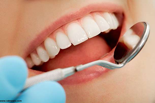 300 میلیون دندان پوسیده در دهان ایرانیان وجود دارد